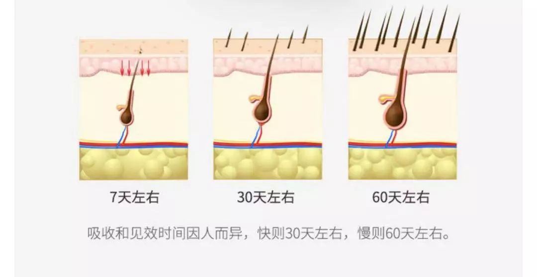 纹眉一周后眉毛还没完全掉痂,纹眉之后我的眉毛不长了