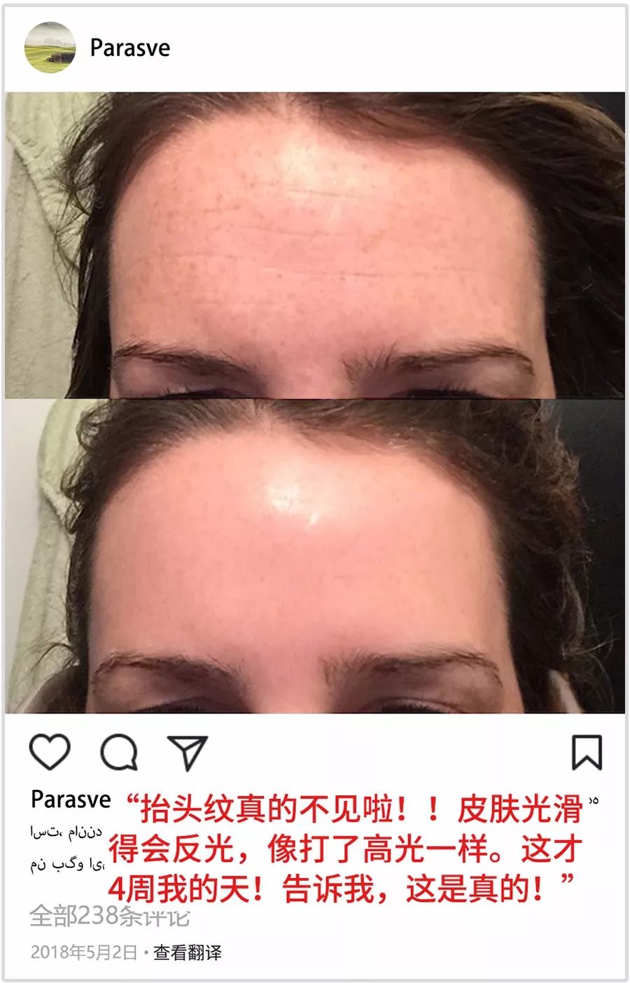 婆孙恋,婆孙恋电视剧