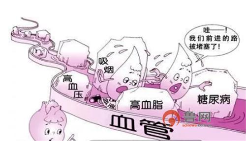 糖尿病医疗突破,糖尿病微创介入