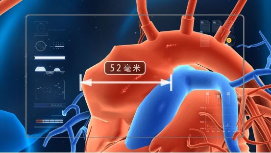 生命缘26岁姑娘长肿瘤,生命缘18岁女孩身患绝症