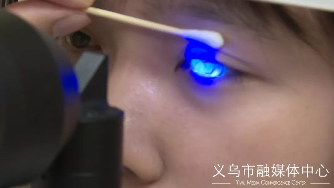 义乌一姑娘，得了病毒性角膜炎！竟然是因为眼药水？