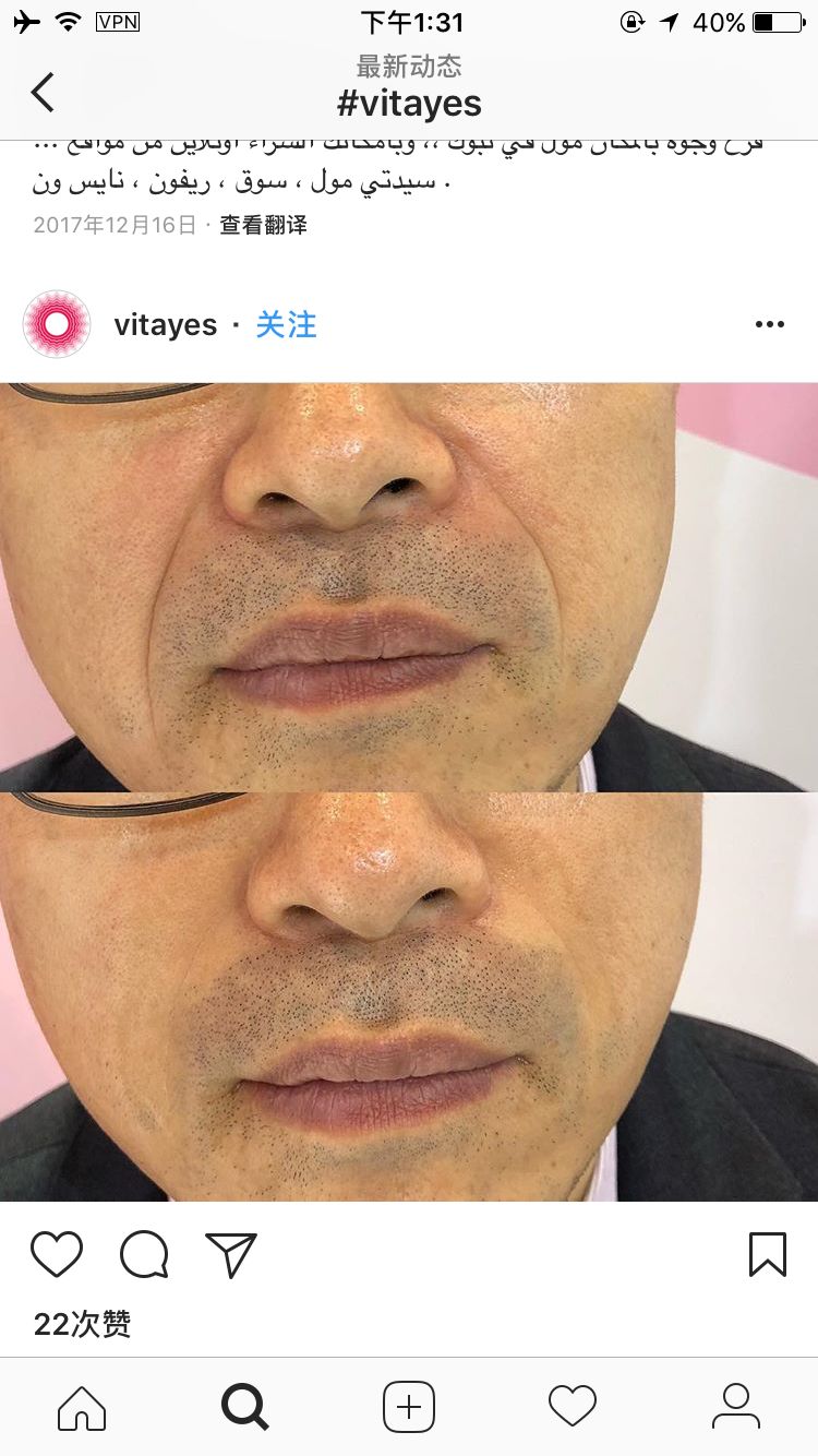 好物|一直忍着没公布！这个用一次就变漂亮的东西！链接拿去