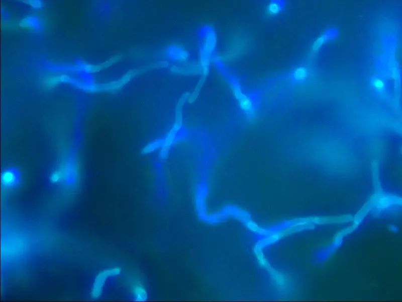 8个月的宝宝竟然得了“香港脚”！医生：梅雨季尤其要多关注