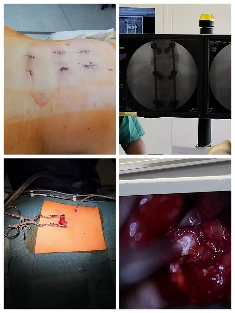 【人大评议专区·聚焦人才培养】西游记：市七院骨科医生远赴德国进修学习纪实