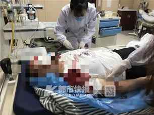 玻璃门倒下妈妈救孩子受重伤,玻璃门倒下妈妈为保护孩子受伤