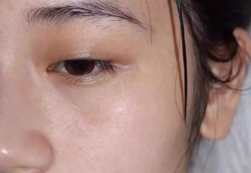 脸上搓下来很多泥,脸上搓出黑头