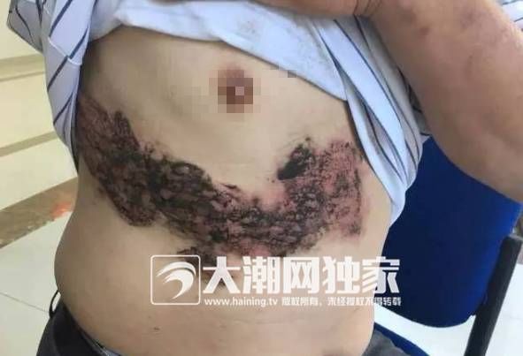 瑙︾洰鎯婂績灏忓,10宀佺敺瀛╄剸瀛愪笂鍏ㄦ槸閽堢溂鏂伴椈