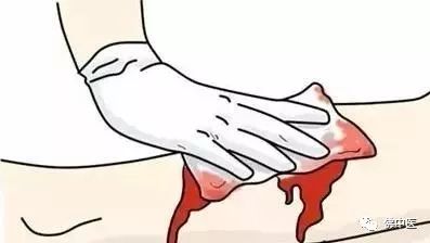 幼儿意外伤处理方法,暑期儿童意外伤害如何预防