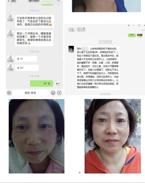 云朵玫瑰值得投资吗,云朵玫瑰代理