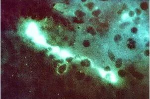 鸟屎为什么有青的,鸟屎为什么是一条条的