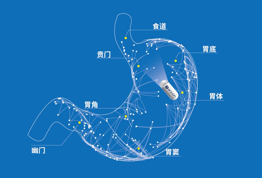 中国磁控胶囊胃镜临床应用指南书,磁控胶囊胃镜临床意义
