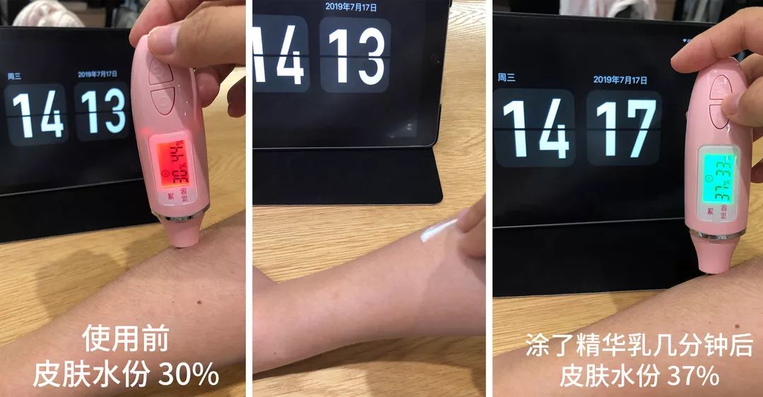 皮肤干燥起皮的救星,皮肤干燥起皮怎么办用什么护肤品