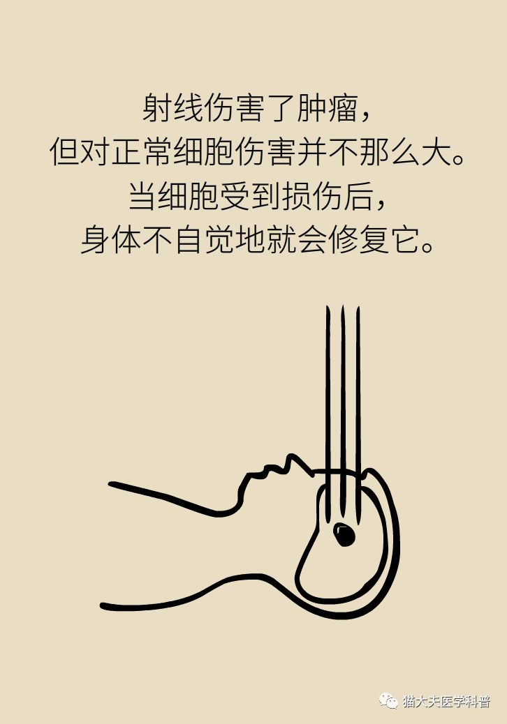 放疗和化疗的区别科普,放疗化疗相关知识