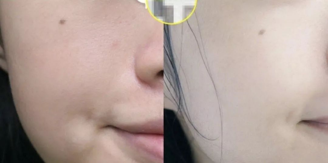 刚秀完恩爱,刚秀恩爱就被分手