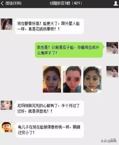 成都医美月▏为朋友埋线却被感染，体内40多根线，30多根都找不到了