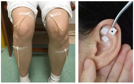 皮肤科荨麻疹的中医疗法,玉颜霜用后为什么起小疹子