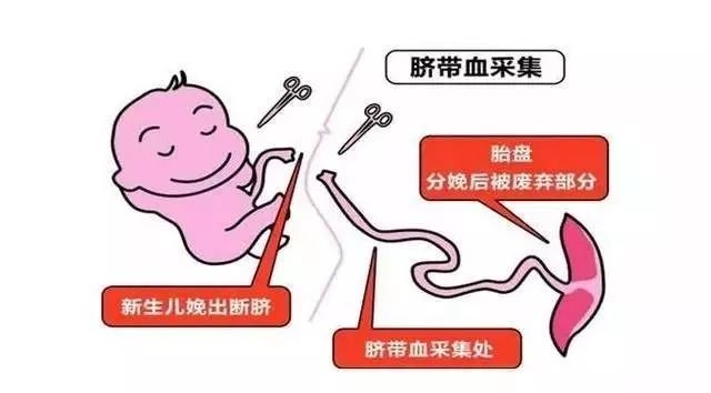 郑州存脐带血,储存脐带血郑州