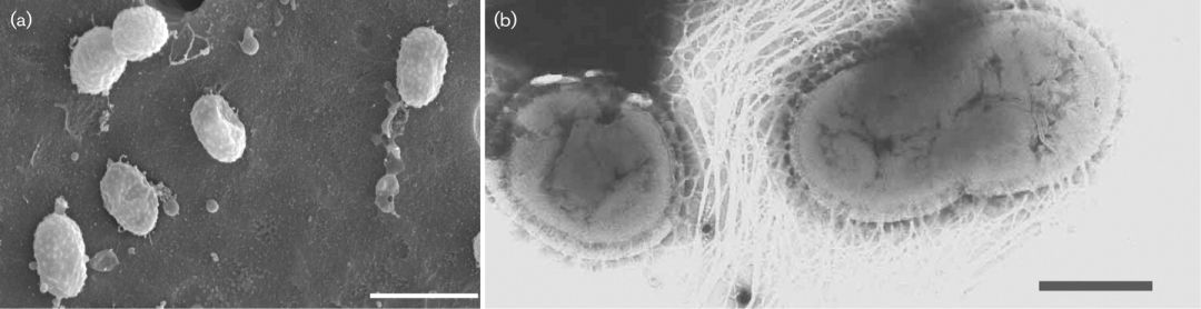 akk益生菌有什么功效,万能益生菌效果怎么样