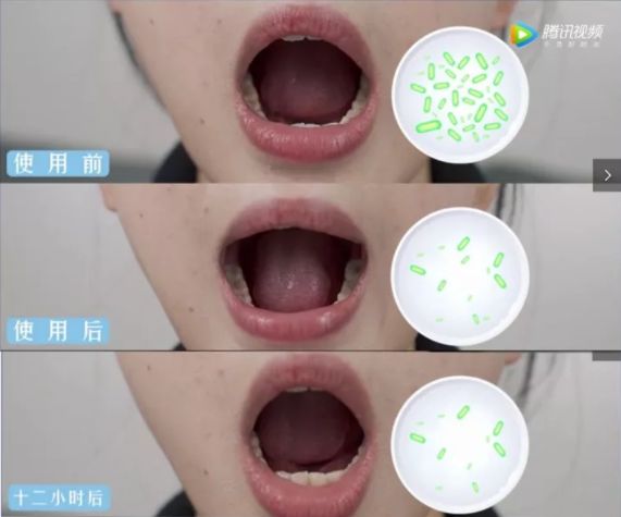 小编推荐丨缓解咳嗽、口臭，试试这个“千金方”！澳洲纯植物提取