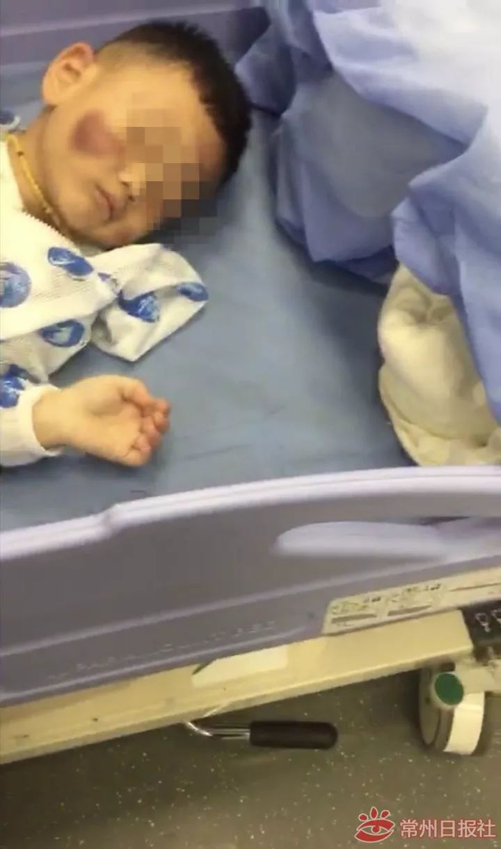 江苏溧阳岁男童疑遭虐,常州2岁男童被虐待致死
