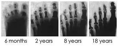 多大适合给孩子穿鞋了,小孩穿鞋好还是光脚好