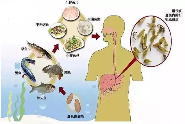 男子体内排出一条活虫,男子体内排出活虫只因爱吃一道菜