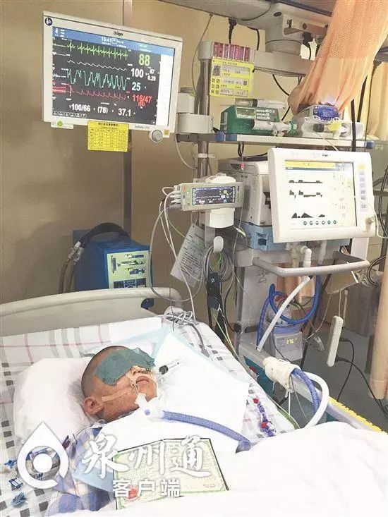 谨慎毒虫视频,警惕这种虫有人被咬后差点没命