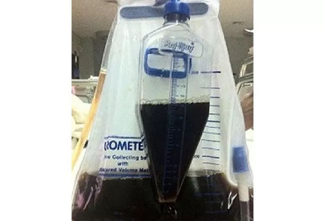 尿液各种颜色都代表什么病,尿液是五颜六色的怎么回事