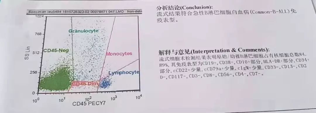 全血细胞减少就是白血病,全血细胞减少性白血病