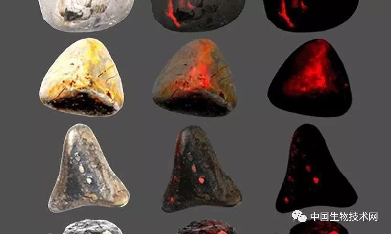 1.2大的胆结石是多长时间形成的,如何发现胆结石