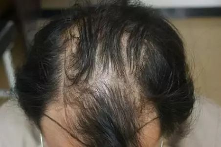 生姜育发洗发水推荐,生姜育发洗发水哪款最有效果