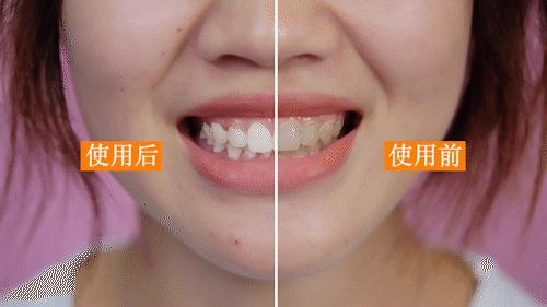 一款美白无敌的牙膏,美白黄牙烟渍最好的牙膏