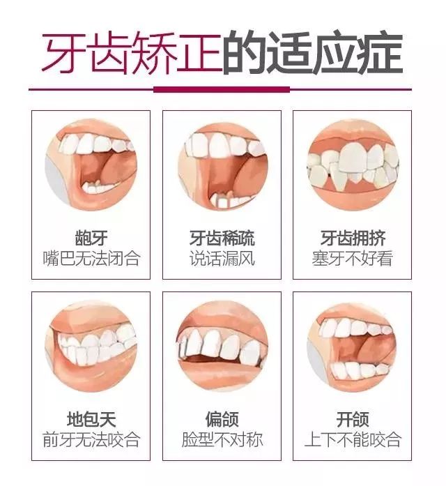 2023年天津种牙能纳入医保吗,天津人有没有什么优惠政策
