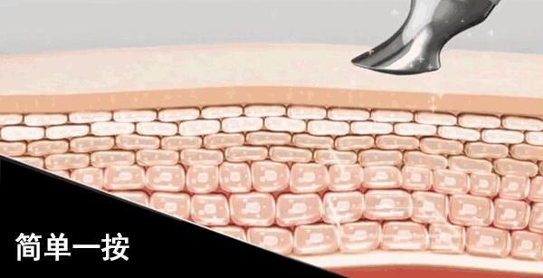 眼袋松弛下垂最快解决方法,严重眼袋下垂松弛怎么恢复