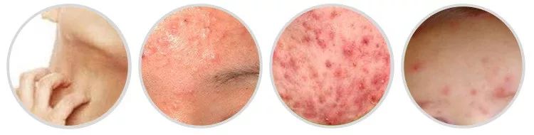 好用的去螨虫喷雾推荐,除螨喷雾排行第一名神器