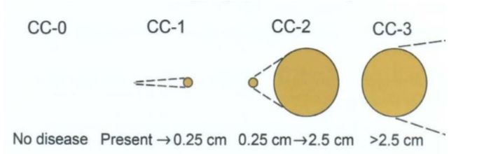崔书中精准腹腔热灌注化疗技术,许洪斌医生的科普号