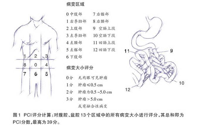 崔书中精准腹腔热灌注化疗技术,许洪斌医生的科普号