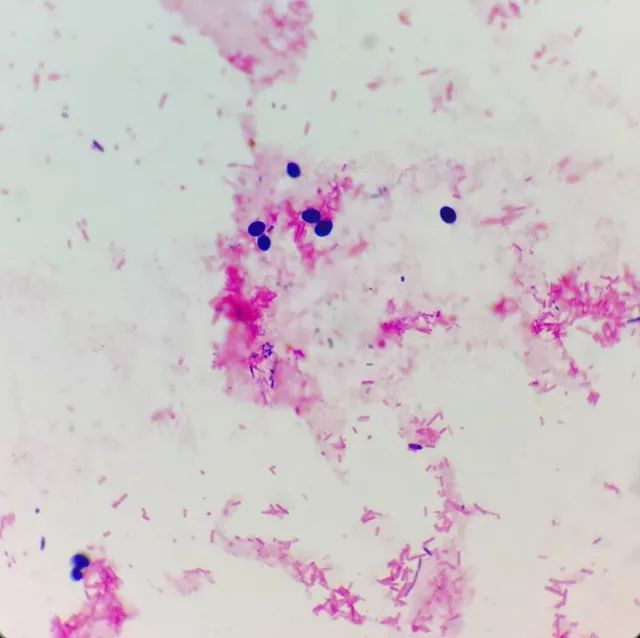 天呐，女儿大便里竟然有“霉菌”