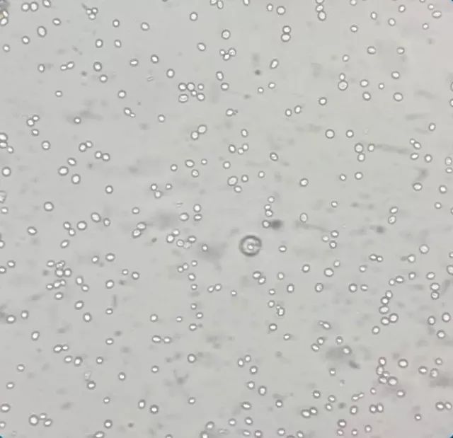 天呐，女儿大便里竟然有“霉菌”