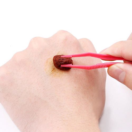 被乌龟咬了要不要打疫苗,乌龟咬了需要打狂犬疫苗吗