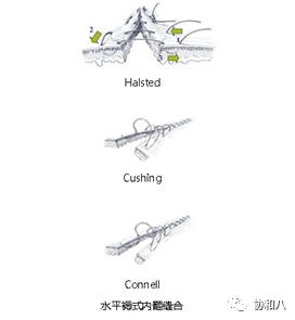 临行密密缝——不同缝合方法特点和适用条件（下）|朝花夕拾·协和八