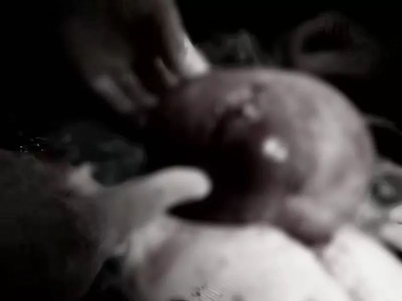 老年人肚子突然大得像怀孕,老人肚子变大圆鼓鼓的很硬不难受