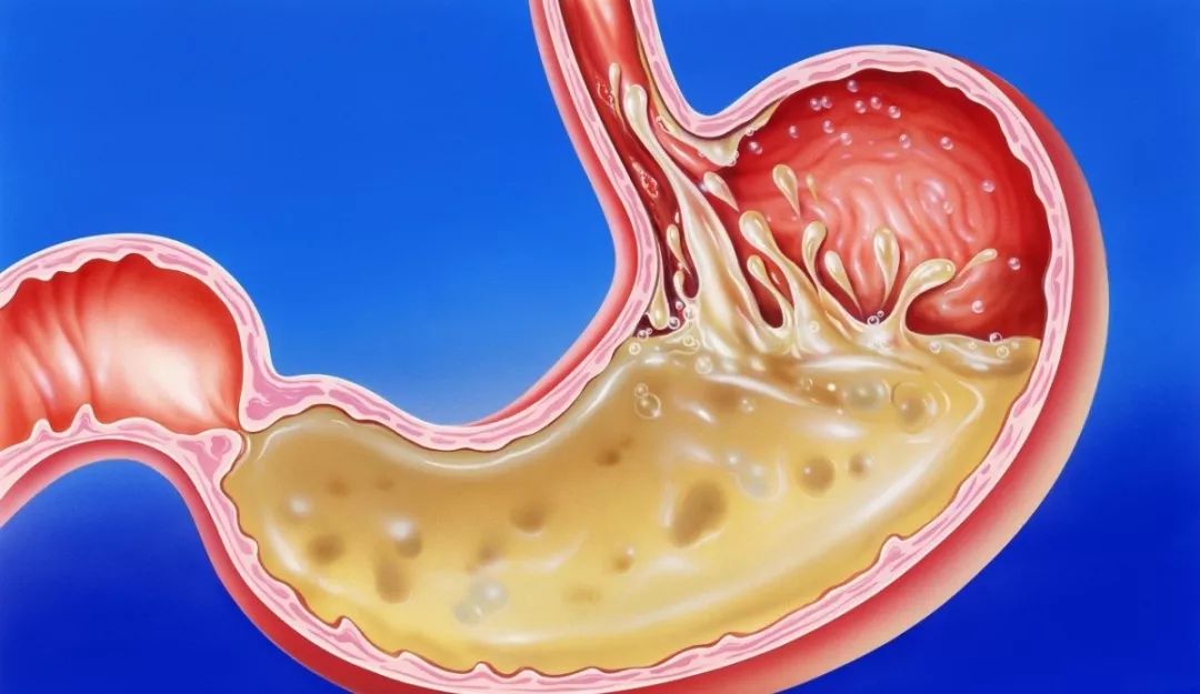 请关注：山西中医学院附属医院胃食管反流病义诊就在9月9日—12日