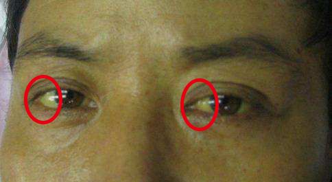 适合熬夜的护眼神器,眼睛劳累用什么护眼神器