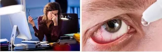 适合熬夜的护眼神器,眼睛劳累用什么护眼神器