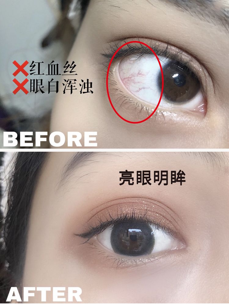 适合熬夜的护眼神器,眼睛劳累用什么护眼神器