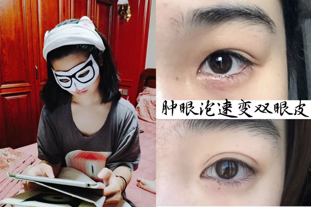 适合熬夜的护眼神器,眼睛劳累用什么护眼神器