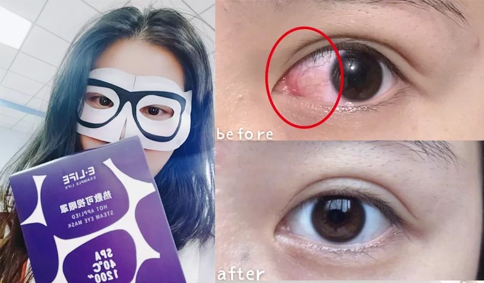 适合熬夜的护眼神器,眼睛劳累用什么护眼神器