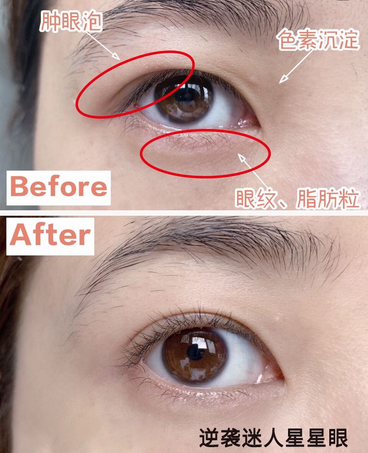 适合熬夜的护眼神器,眼睛劳累用什么护眼神器