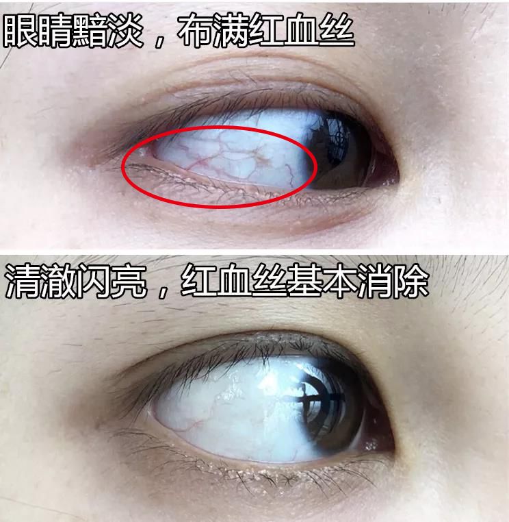 适合熬夜的护眼神器,眼睛劳累用什么护眼神器